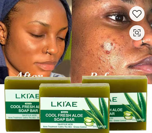 Savon aloe verra pour bouton et taches éclaircissant